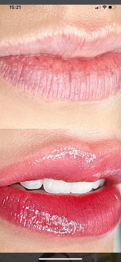 Micropigmentação labial